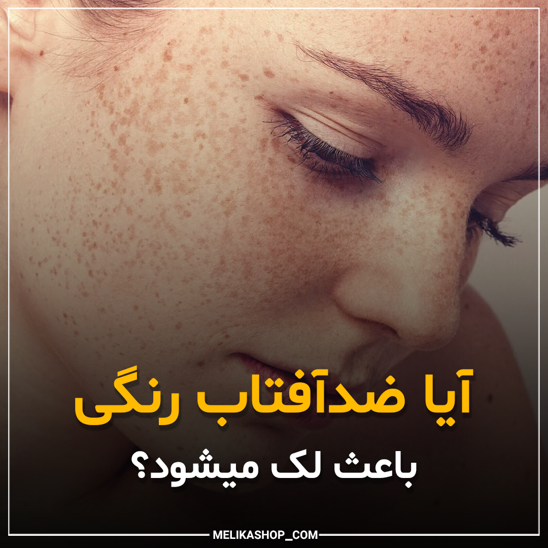 ضدآفتاب رنگ یاعث لک میشود؟