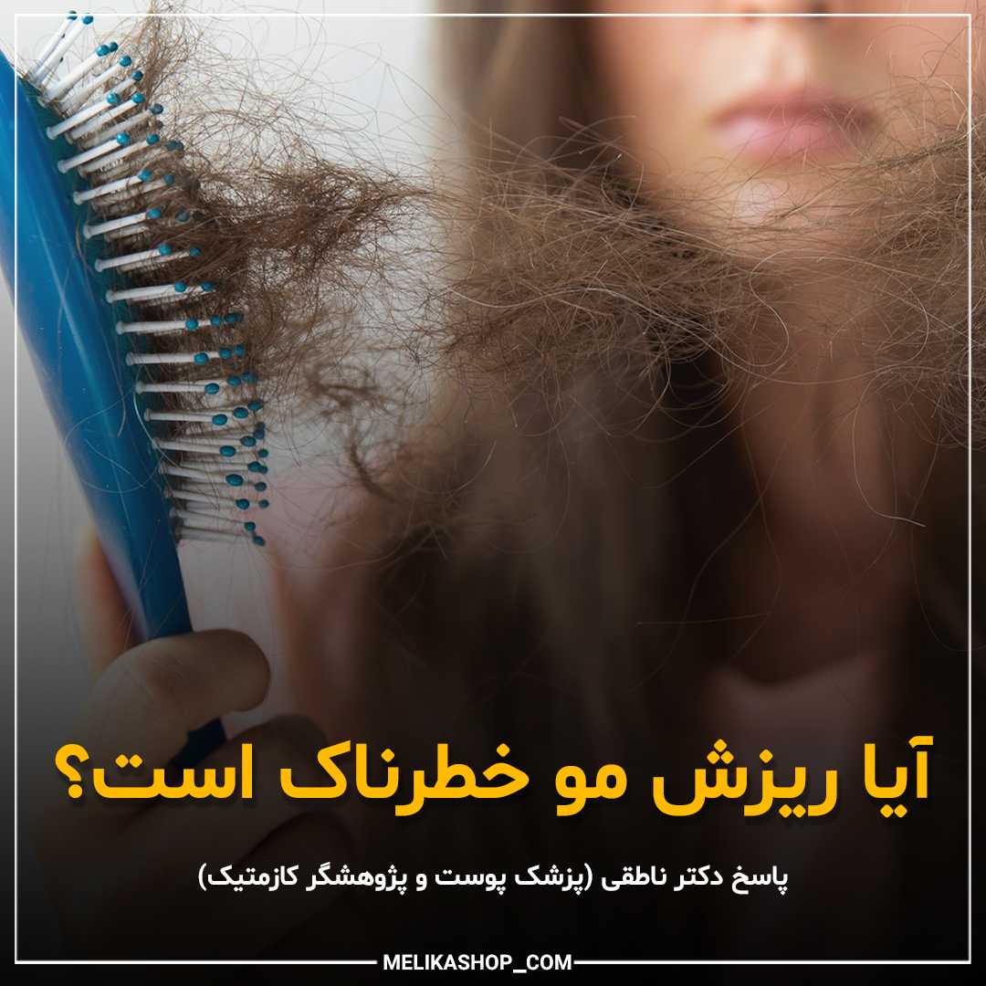 ریزش مو