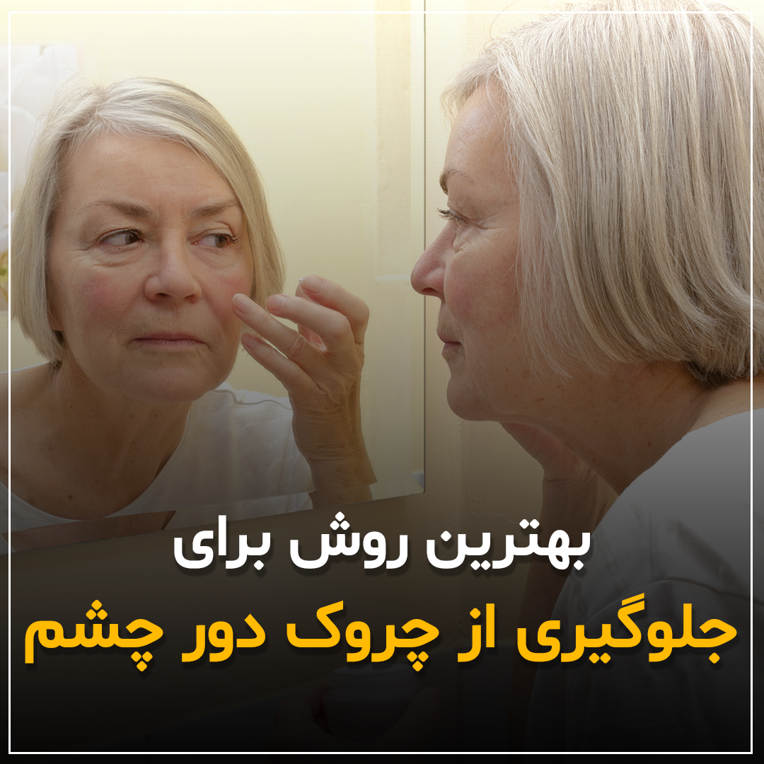 جلوگیری از چروک دور چشم