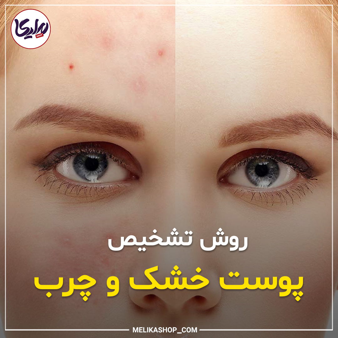 روش تشخیص پوست چرب و خشک