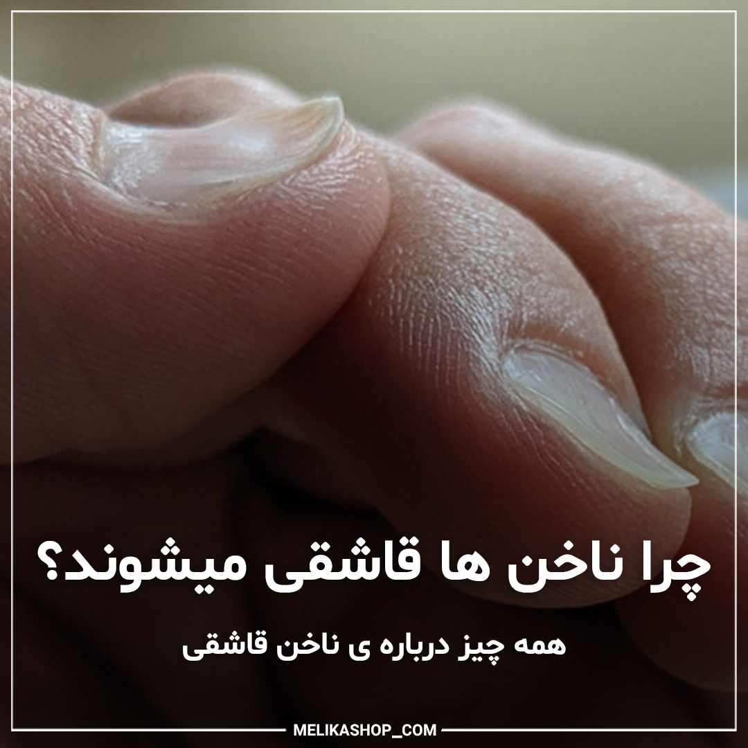 علت ناخن قاشقی و درمان آن