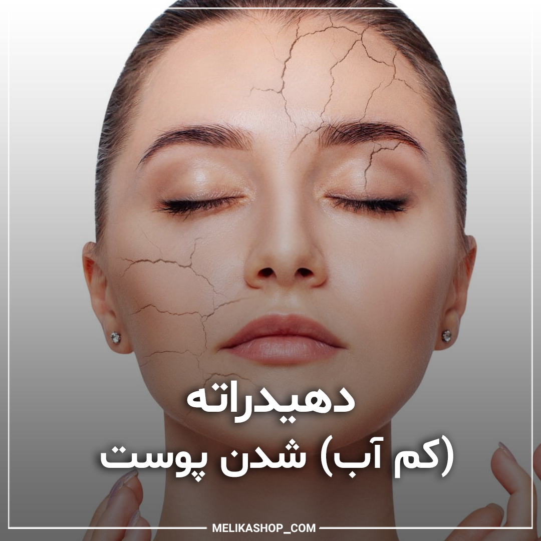 Dehydration of the skin