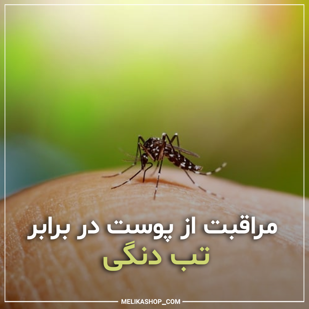 مراقبت از پوست در برابر تب دنگی
